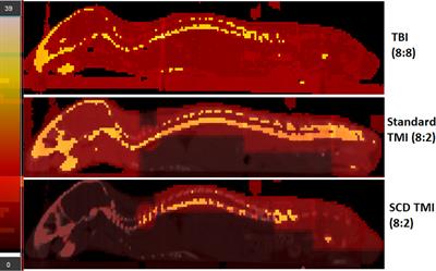 Development and characterization of a preclinical total marrow irradiation conditioning-based bone marrow transplant model for sickle cell disease